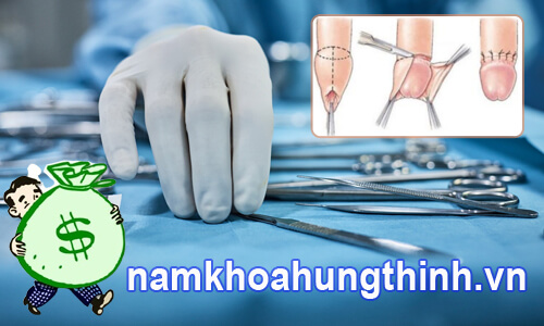chi phí cắt bao quy đầu giá bao nhiêu tiền