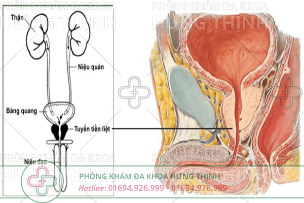 Những bệnh nam khoa thường gặp hiện nay