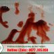 xuất tinh ra máu là bệnh gì