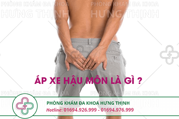 Bệnh apxe hậu môn là gì, có nguy hiểm không?