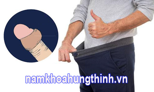 dài bao quy đầu có nên cắt không