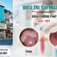 chi phí điều trị bệnh sùi mào gà