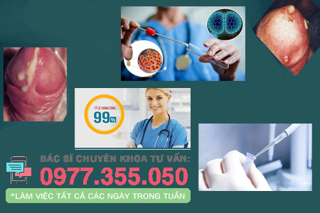 chữa bệnh lậu bằng DHA