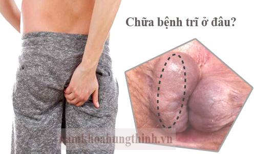 khám trĩ ở đâu