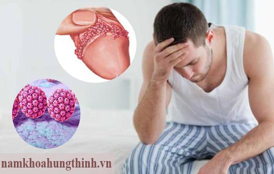 chữa sùi mào gà ở đâu tốt