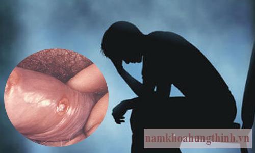 Đáng giá về địa chỉ chữa giang mai Hưng Thịnh