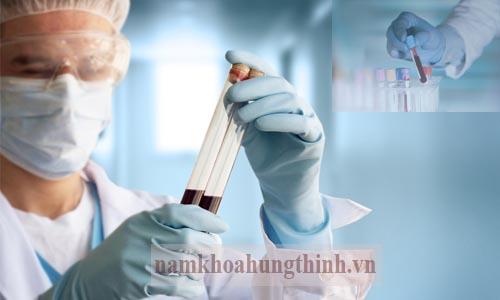 Xét nghiệm bệnh lậu tại Khoa Da liễu - Bệnh viện Bạch Mai Xét nghiệm bệnh lậu tại Khoa Da liễu - Bệnh viện Bạch Mai