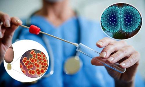 xét nghiệm bệnh lậu
