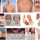 Giang mai bệnh xã hội nguy hiểm nhất