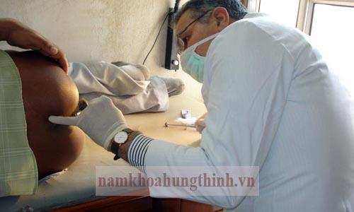 chi phí mổ trĩ