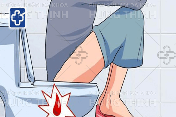 Đi cầu ra máu tươi là bệnh gì ?