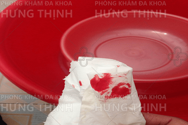 Đi cầu ra máu tươi là bệnh gì ?