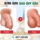 Hình ảnh trước và sau khi cắt bao quy đầu