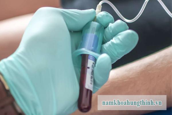 Xét nghiệm bệnh giang mai ở đâu chuẩn xác 