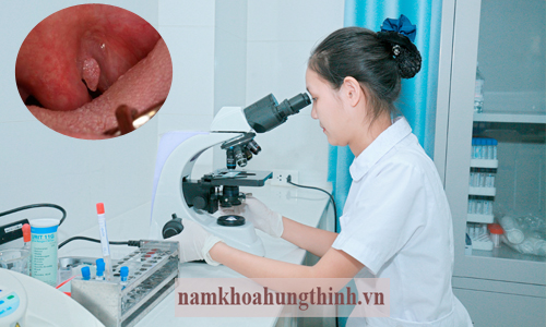 Xét nghiệm sùi mào gà tại Hưng Thịnh