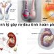 Đau tinh hoàn phải: Nguyên nhân, triệu chứng và cách chữa