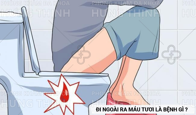Đi ngoài ra máu tươi là bệnh gì