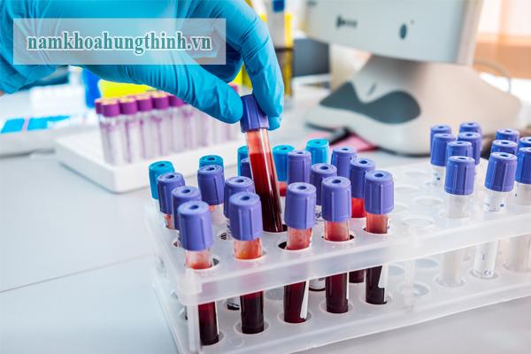 Kết quả xét nghiệm treponema pallidum rpr