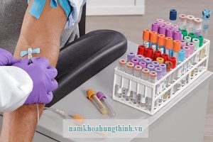 Xét nghiệm giang mai bao lâu có kết quả