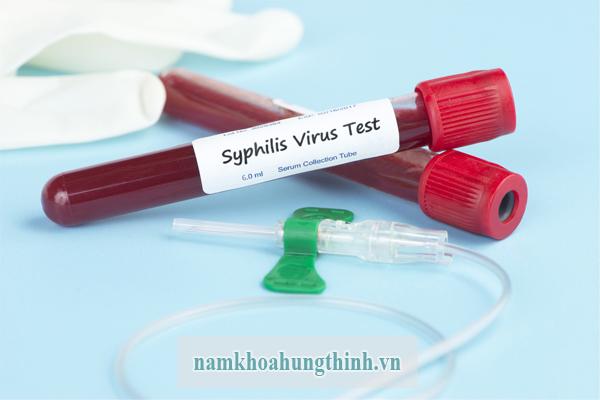 Xét nghiệm bệnh giang mai