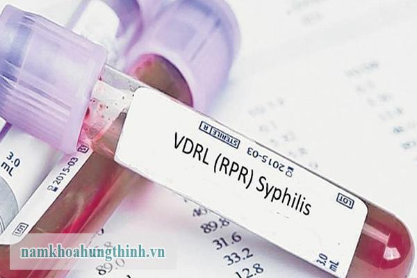 Xét nghiệm rpr