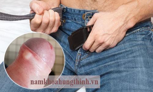 sưng, ngứa, đỏ bao quy đầu