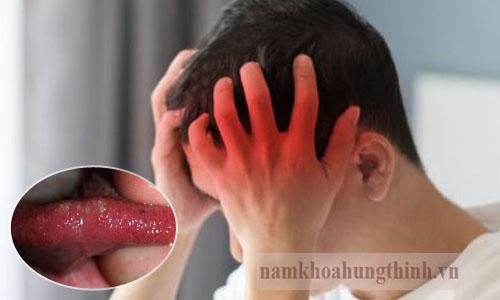 Cuống lưỡi nổi mụn đỏ