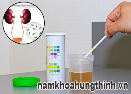xét nghiệm nước tiểu để tìm ra viêm đường tiết niệu