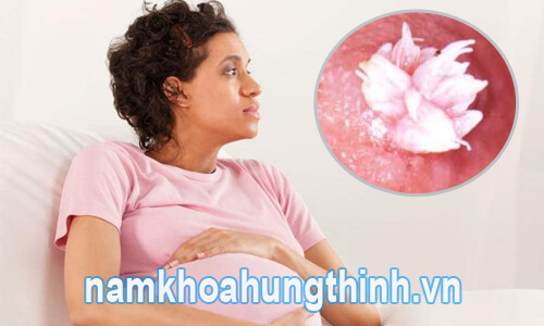 Tác hại của sùi mào gà ở phụ nữ mang thai