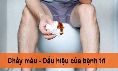 dấu hiệu của bệnh trĩ vòng
