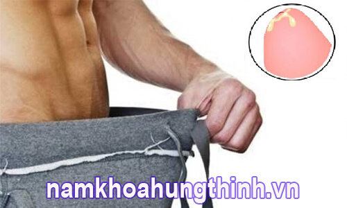 Chảy máu và mủ sau khi cắt bao quy đầu