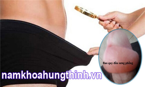 bao quy đầu bị phù nề sau khi cắt