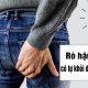Rò hậu môn có tự khỏi được không