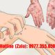 Bệnh giang mai có gây ngứa không