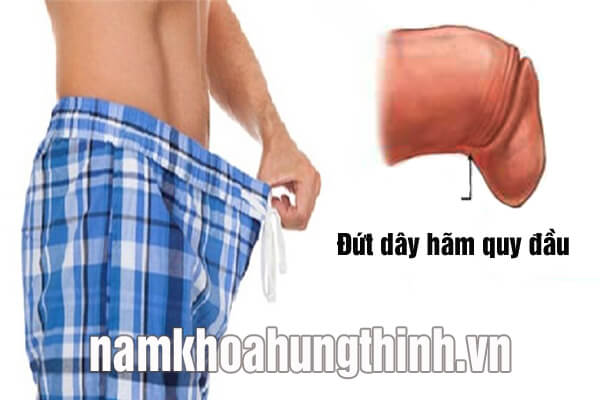 Dây hãm quy đầu bị đứt