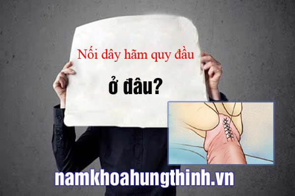 nối dây hãm quy đầu ở đâu