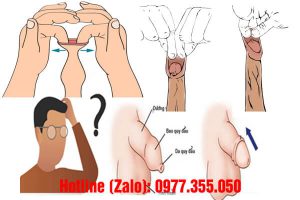 nên lột bao quy đầu khi nào